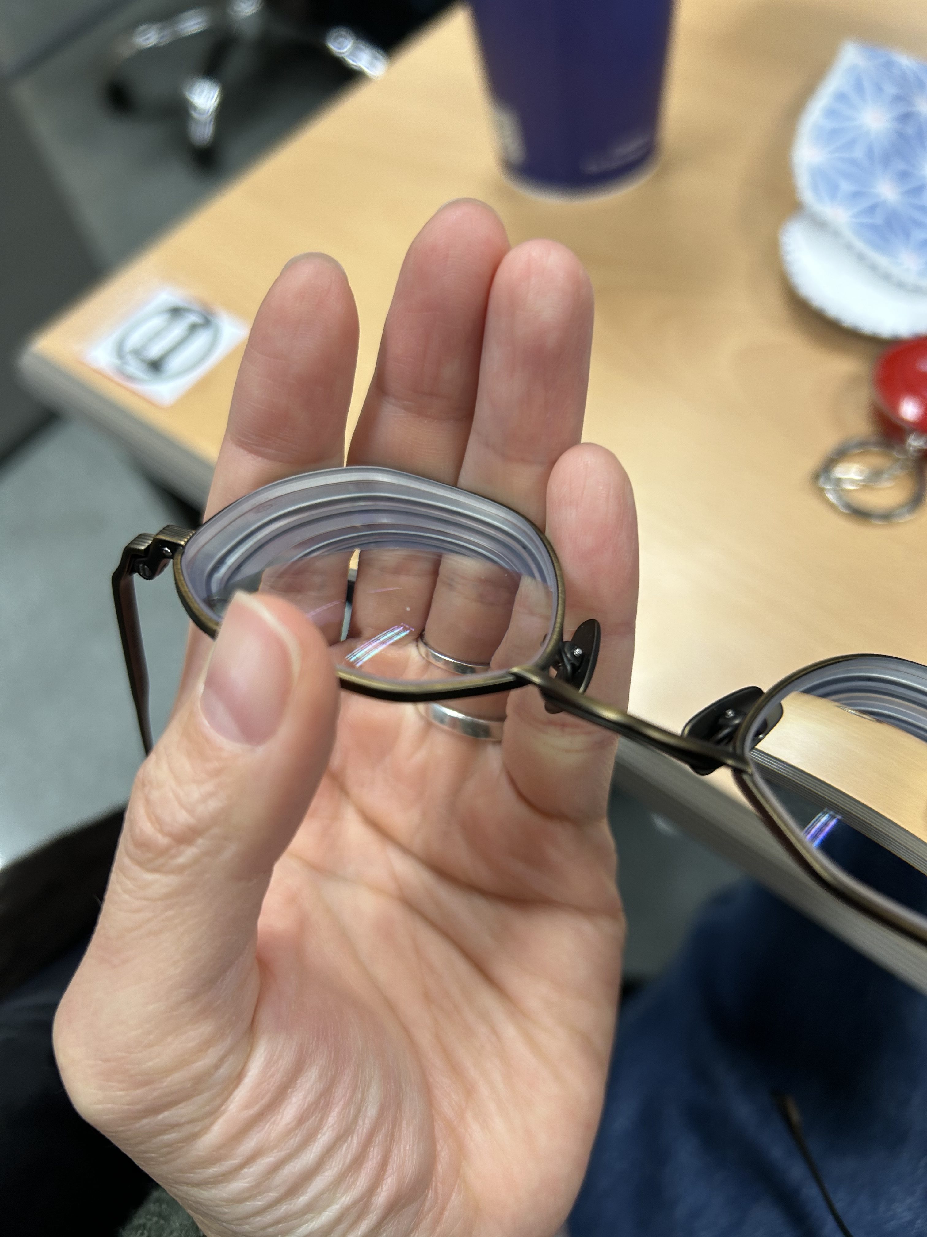 초고도 근시의 고충